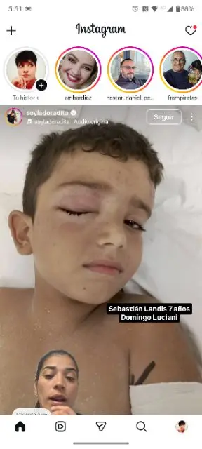 Sebastián Landis
