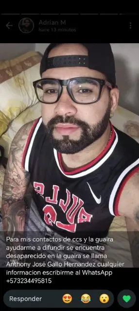 Anthony José gallo Hernandez